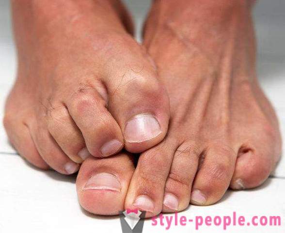La peau sèche sur vos pieds: Causes
