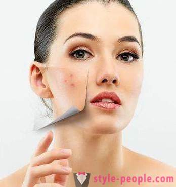 Comment pores étroit sur votre visage? Masque, resserre les pores. Soins de la peau